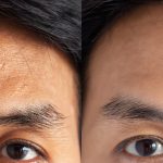 Skincare Treatment