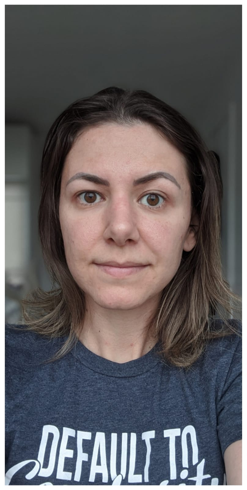 Woman before the microcurrent facial treatment